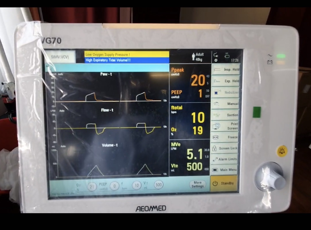 ZTE dona alla Protezione Civile 5 respiratori per la terapia intensiva