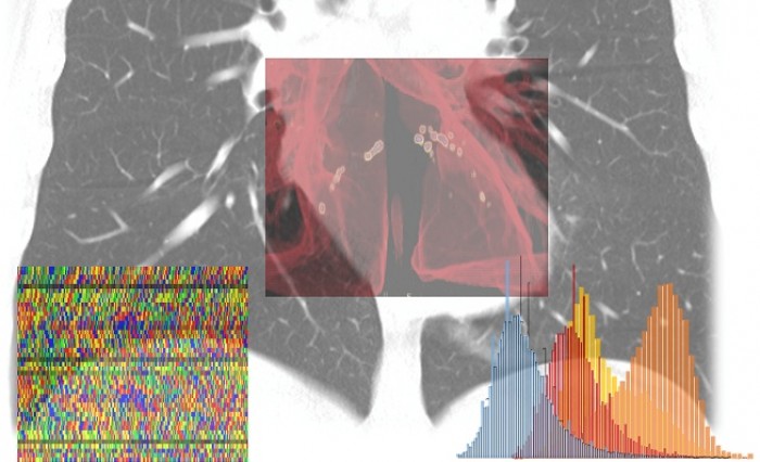 Al via il progetto AI-SCoRE per calcolare il rischio da Covid-19